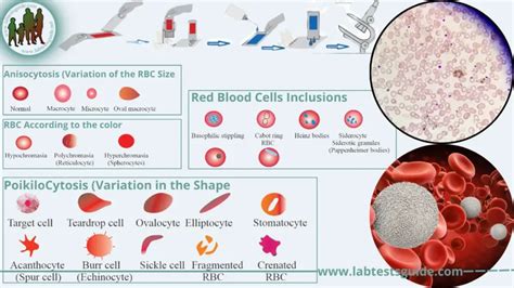 Blood Smear: Purpose, Procedure, and Results.